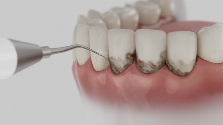 Reliable Dental Implants contractor in Tustin, CA by Smile Center Dentistry